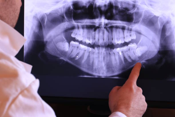 Best Pediatric Emergency Dentist in Severna Park, MD