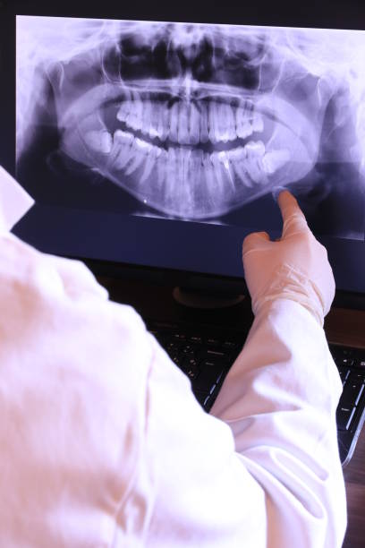 Best Holiday Emergency Dentist in Severna Park, MD