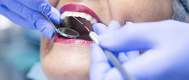 Best Broken or Cracked Tooth Emergency Dentist in Severna Park, MD